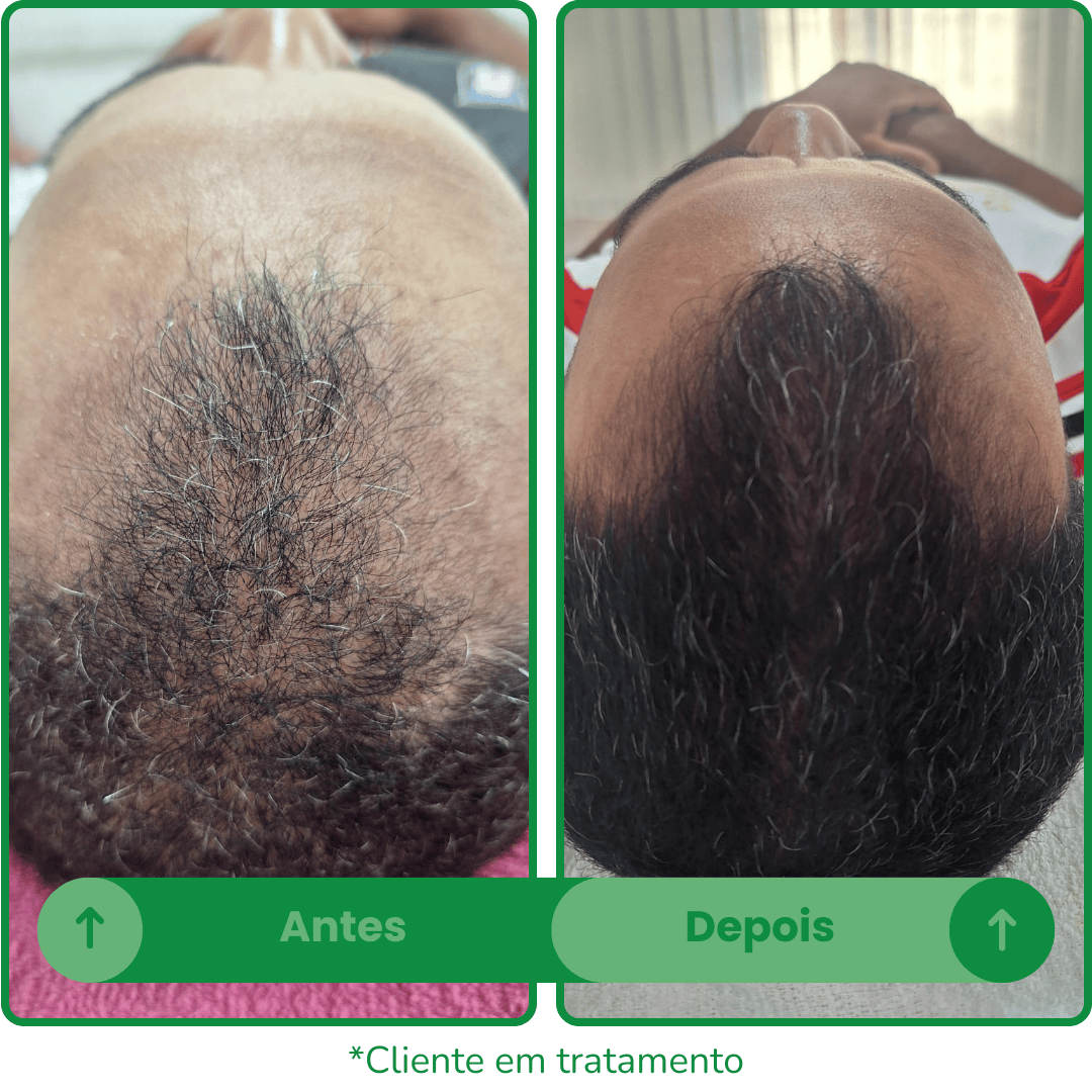 Antes e depois 3